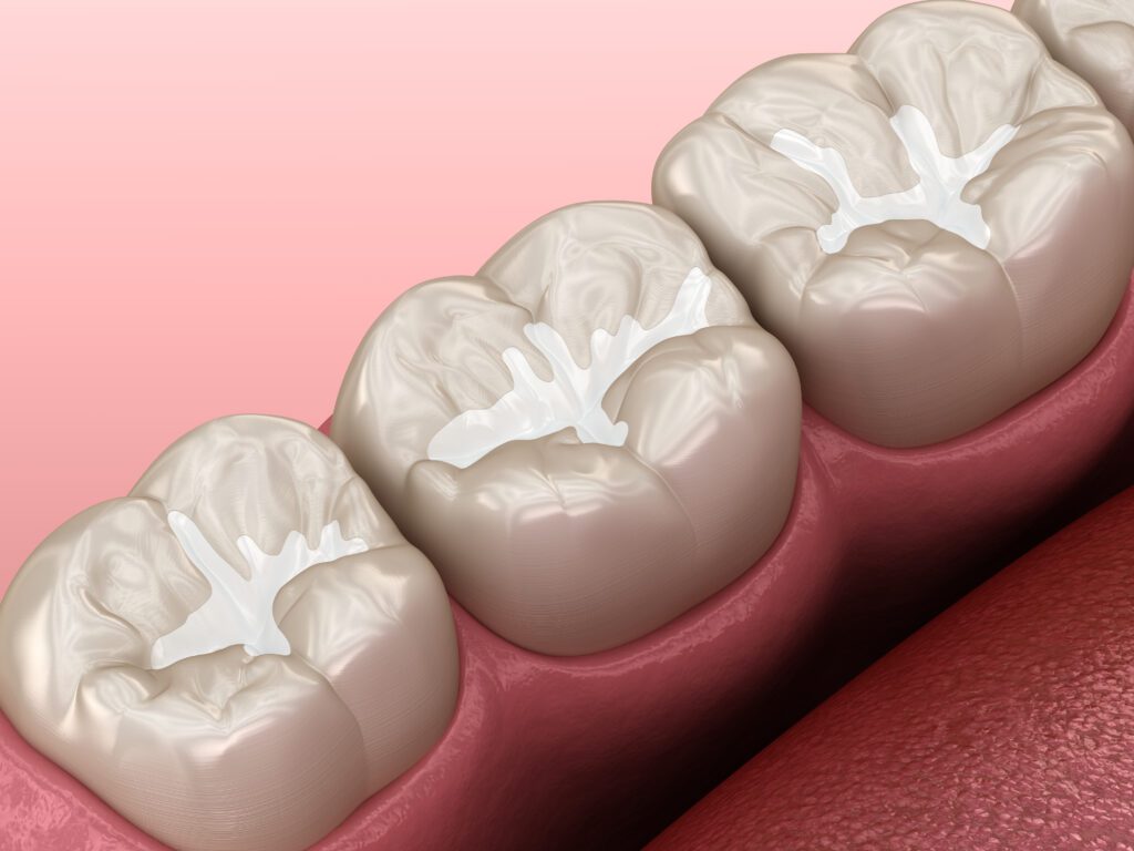 Hummelgard Dentistry -